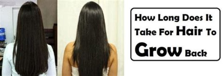Does hair grow back?